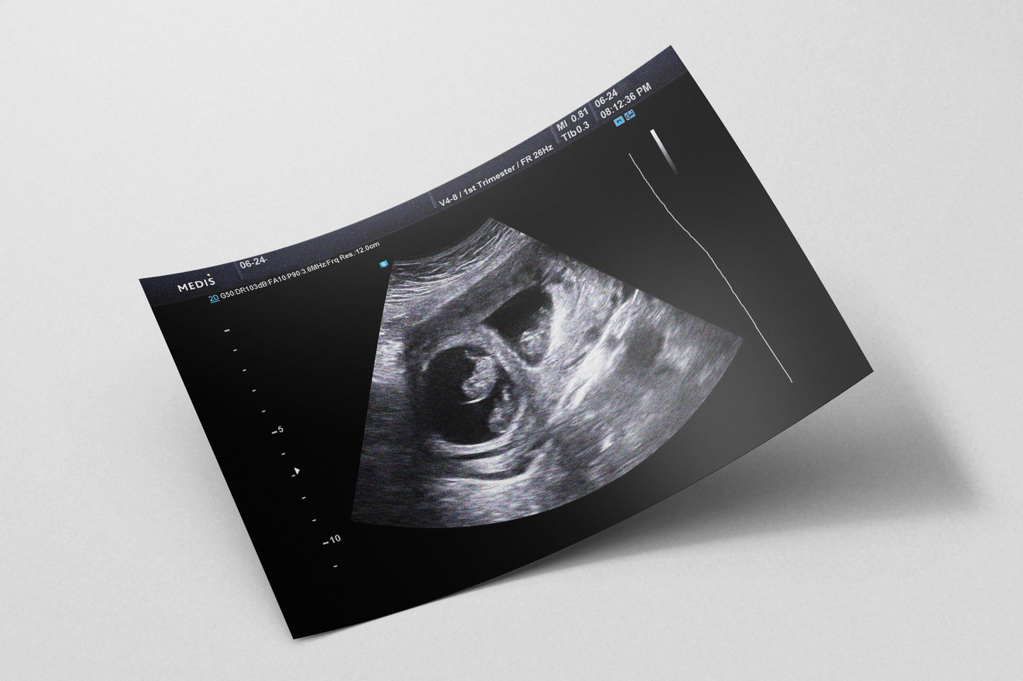 Prop Documents Ultrasound V1 27x18.4cm
